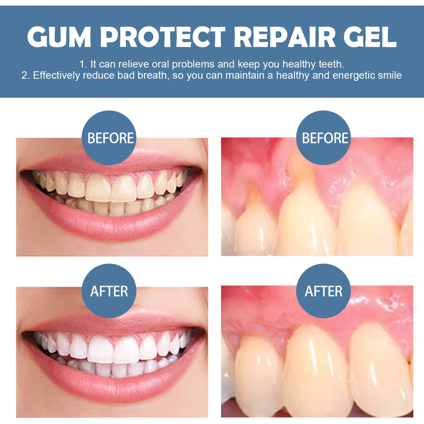 Braveba-Gingival repair gel deeply cleans tooth dirt