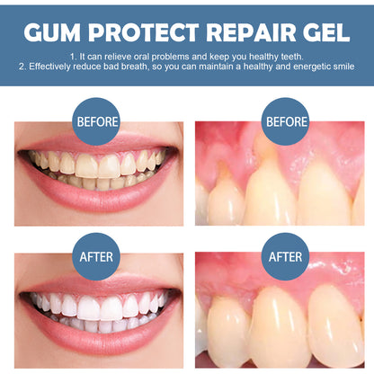 Braveba-Gingival repair gel deeply cleans tooth dirt